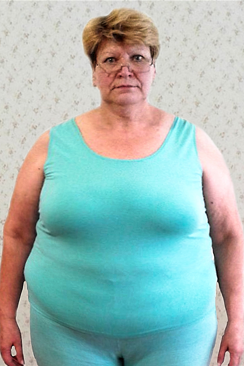 Азюкова Вера до диеты